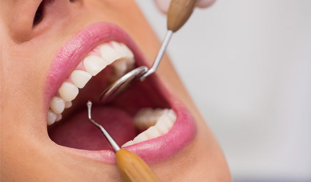 The Importance of Regular Dental Check-ups